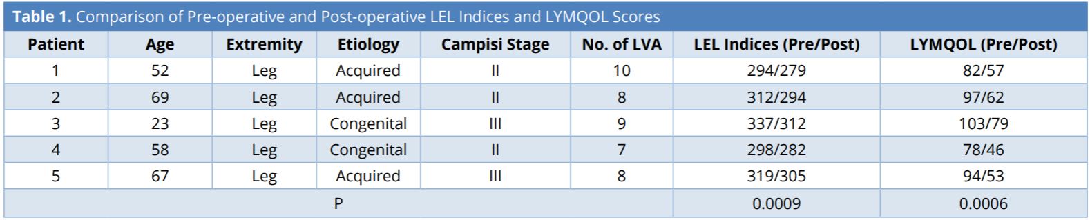 Table 1.JPGComparison of pre-operative and post-operative LEL indices and LYMQOL scores. <br><sub>Lymphedema index is a circumference-based system that takes measurements at five limb levels and references the sum to the patient’s body mass index. LYMQOL is a validated lymphedema-specific quality of life assessment that tracks four condition-specific domains – function, appearance, symptoms, and mood. LEL, lower extremity lymphedema; LYMQOL, lymphedema-specific quality of life assessment; LVA, lymphaticovenular anastomosis; Pre, pre-operative; Post, post-operative.